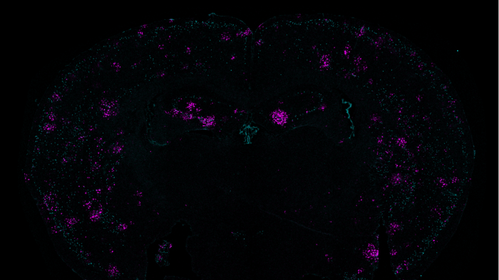 Double-strand breaks and the response