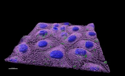 Nanoplastics inside a zebra fish cell