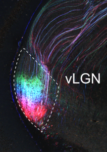 Image of the ventral lateral geniculate nucleus