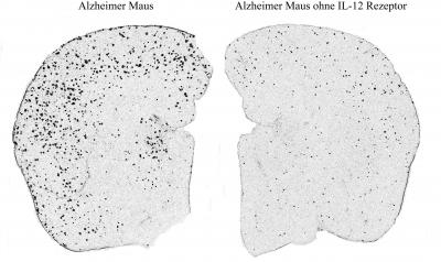 Alzheimer Maus (German Version)