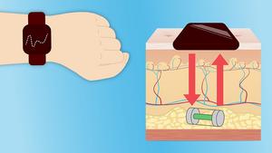 injectable glucose monitor