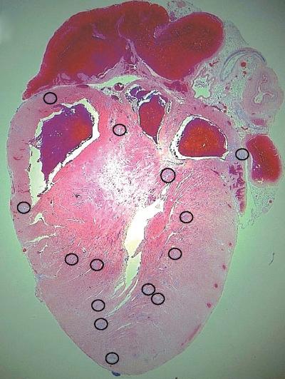 Mouse Heart with Microlesions