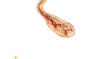 Juvenile nematode in root