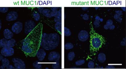 Figure 2: Localization Change