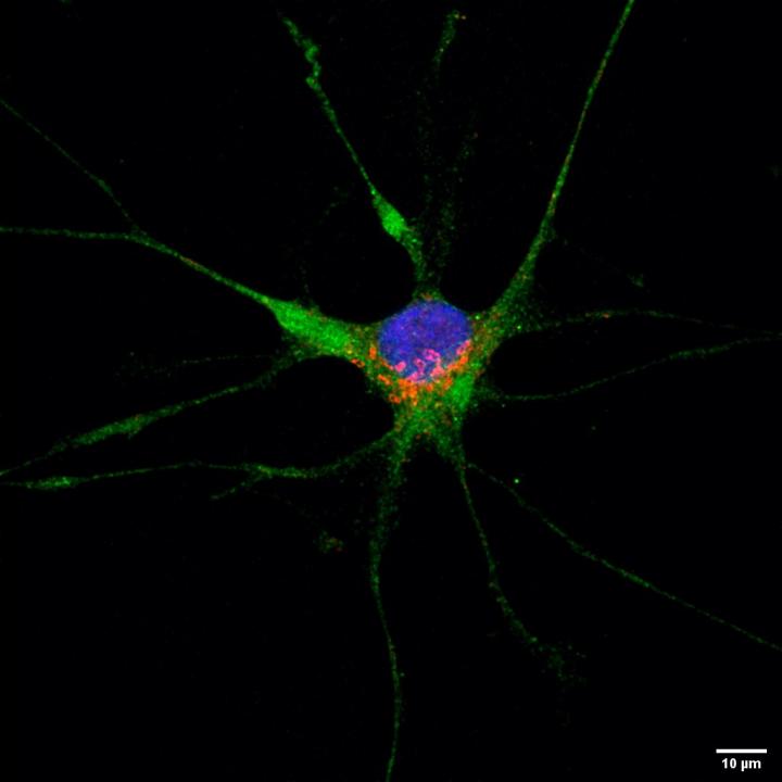 Astrocyte displaying expression of the SARS-CoV-2 receptor protein