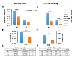 Peking University research team discovers new way to treat amblyopia in children