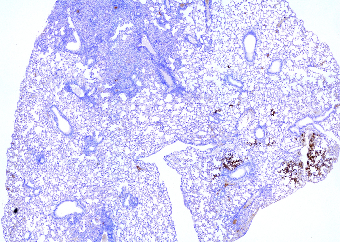 Tuberculosis infection protects mice from developing COVID-19