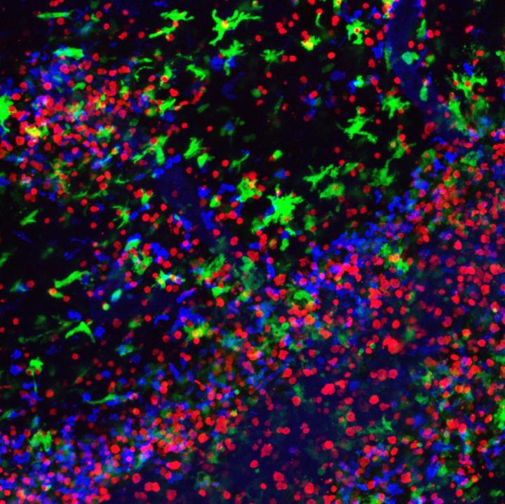 Luring Autoimmune T Cells