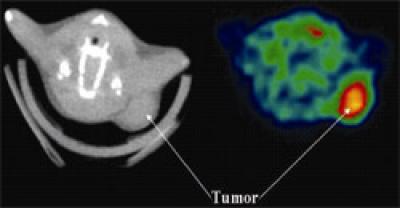 Tracer Can Target Tumors