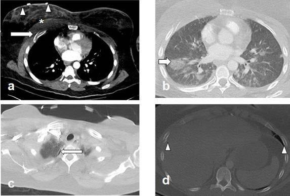 New Study Shows Increase in Domestic Violence Injuries during COVID-19