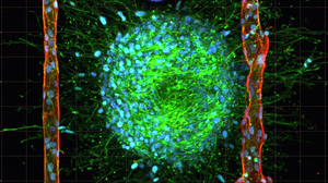 Artificial brain cancer tissue engineered with new technique