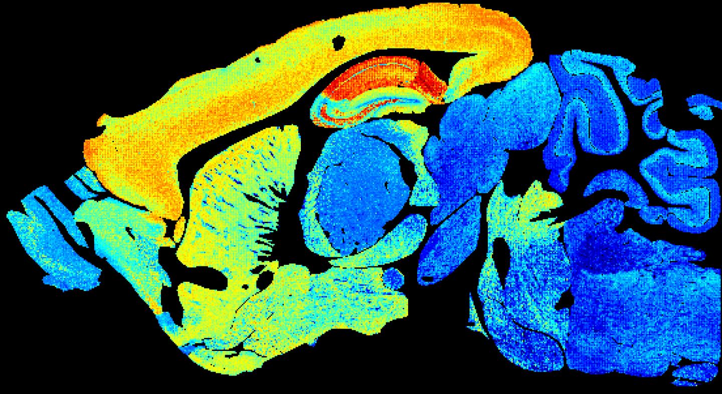 Adult mouse brain section showing increased synapse diversity.