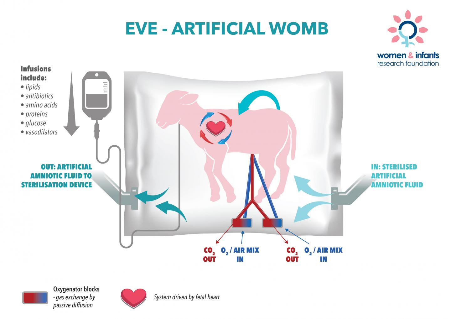 Artificial Womb Raises Hope for Premature Babies