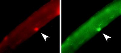 Activated Muscle Stem Cells