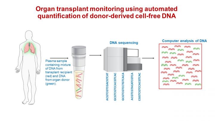 Donor-Derived Cell-Free DNA Blood Test