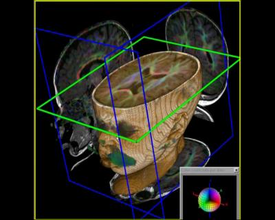 12-Month-Old Child TAC