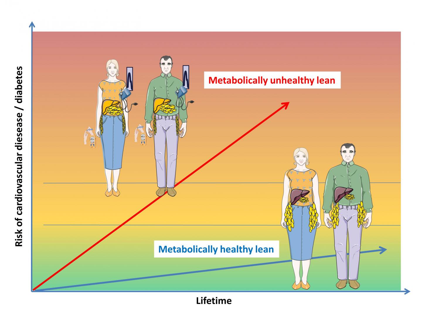 Lean Metabolically Unhealthy People