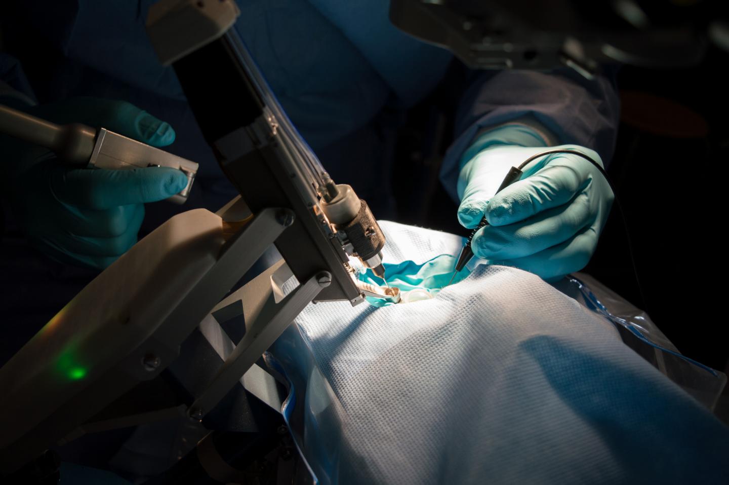 Robotic Surgery Preceyes