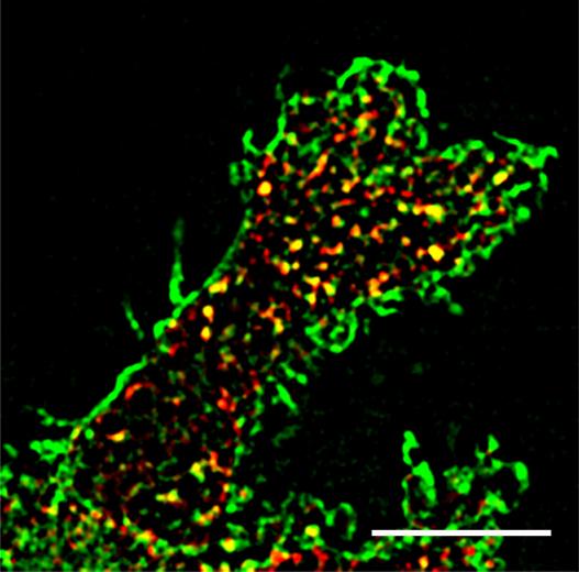 The Mevalonate Pathway Activates Arf6