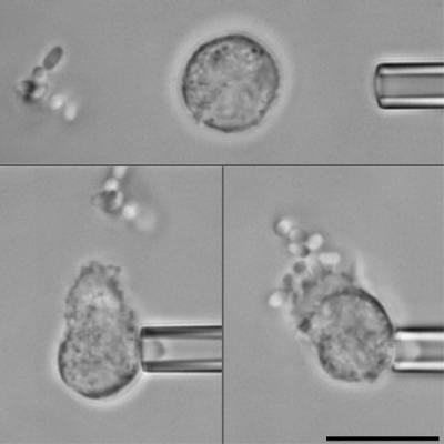 Human Neutrophil With S. Typhimurium