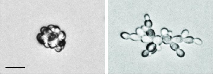 Yeast Colonies in Nutrient-Rich and Nutrient-Limited Conditions
