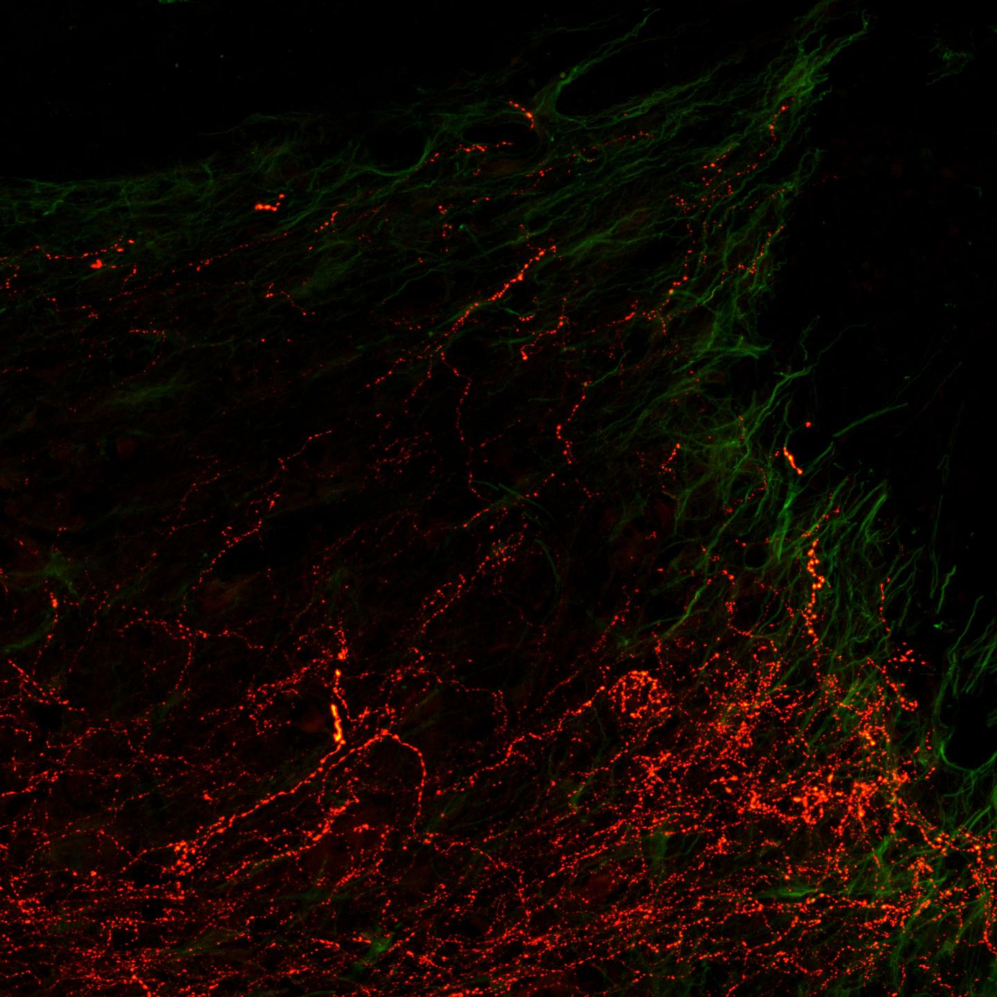 Axons at the Spinal Cord Injury Site