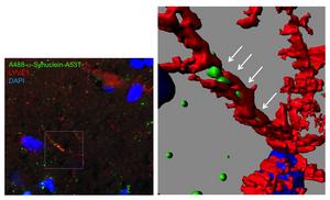 Figure 1  Fluorescent α-synuclein in the brain lymphatic system