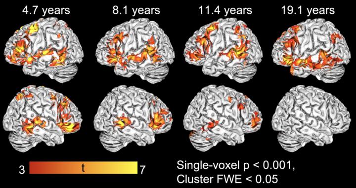 Examples of Individual Activation Maps in Each of the Age Groups