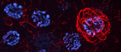 Why Does Making New Egg Cells Require so Much Cell Death?
