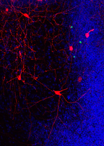 Network of the neurons