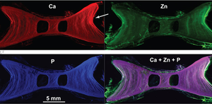 X-ray excited scanning fluorescence map of Ca, Zn, and P intensities.