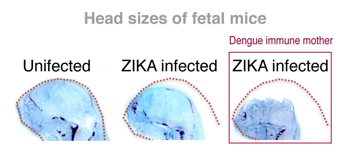 In Mice, Mother's Immunity to Dengue Promotes Microcephaly-Like Syndrome in Fetuses (1 of 2)