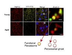 Slide showing peroxisomes under magnification