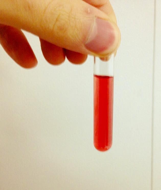 Purified ancestral hemoglobin