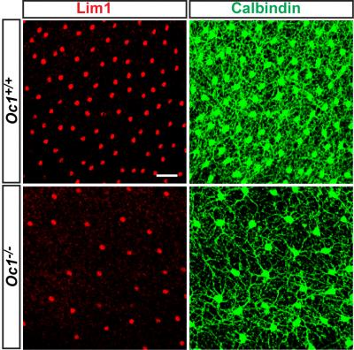 Comparison of Horizontal Cells