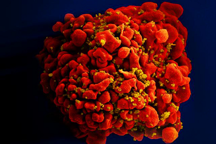 T-cell infected with HIV