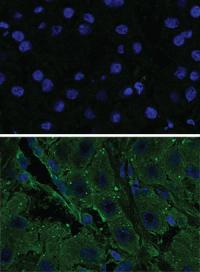 Kinase Activity in Fibrolamellar Tumor Cells