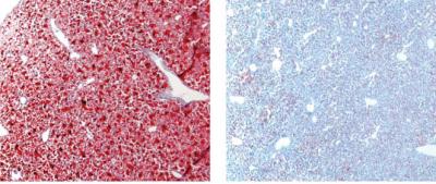Fat Accumulation in SCD+ and SCD- Mouse Liver