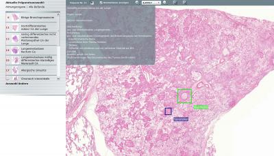 Flexible learning in a virtual microscope lab | EurekAlert!