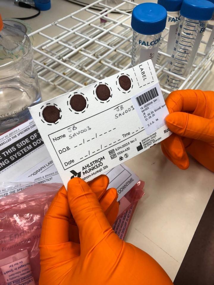 Dry Blood Spot Sample Card