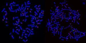 DNA damage on chromosomes in cancer cells