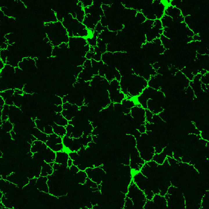 Microglia [IMAGE] | EurekAlert! Science News Releases