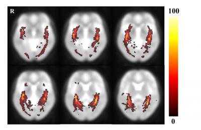 Optic Radiation Probability 