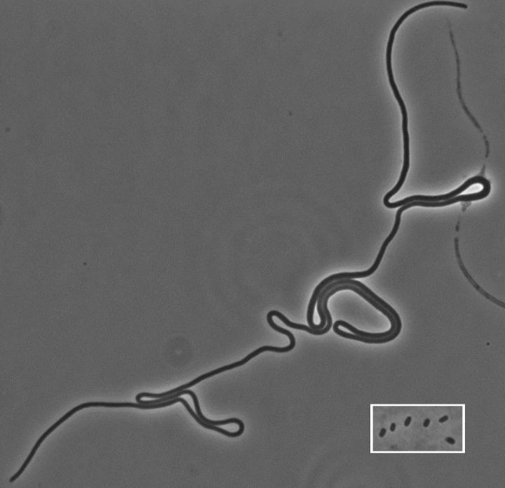 Very Long <i>E. Coli</i>
