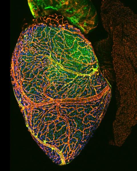 Zebrafish Heart