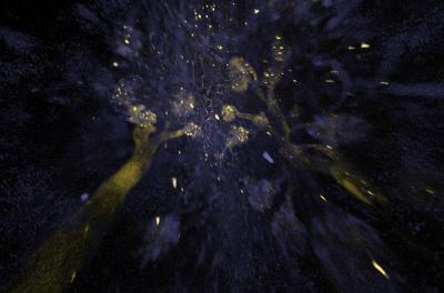 3D Visualization of Intact Kidney Tissue