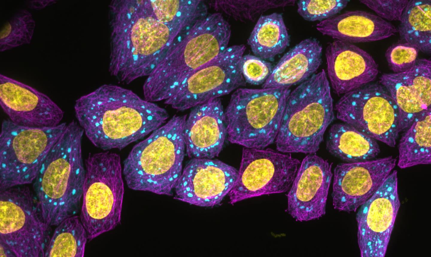 Fluorescence microscopy image 1