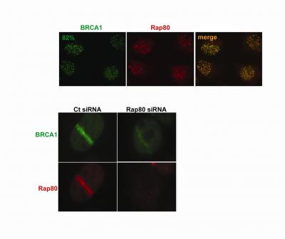 Possible New Breast Cancer Gene
