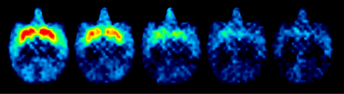 Dose-dependent occupancy of D1-like receptors following administration of D1R selective blocker
