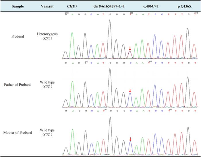 Sanger sequencing results.